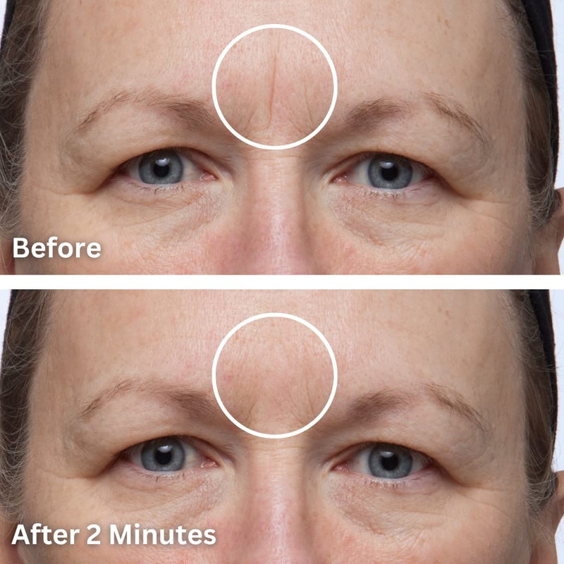 Dermaflage Scar Filler, Refill Applicator - Image 3
